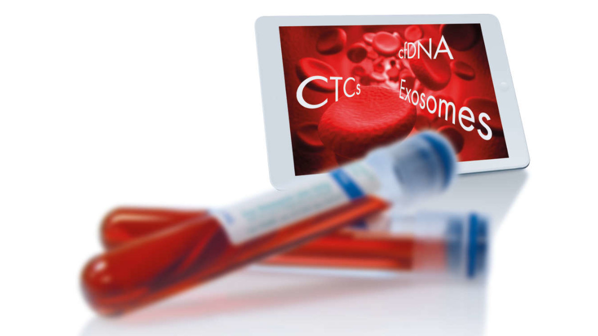 Liquid Biopsy