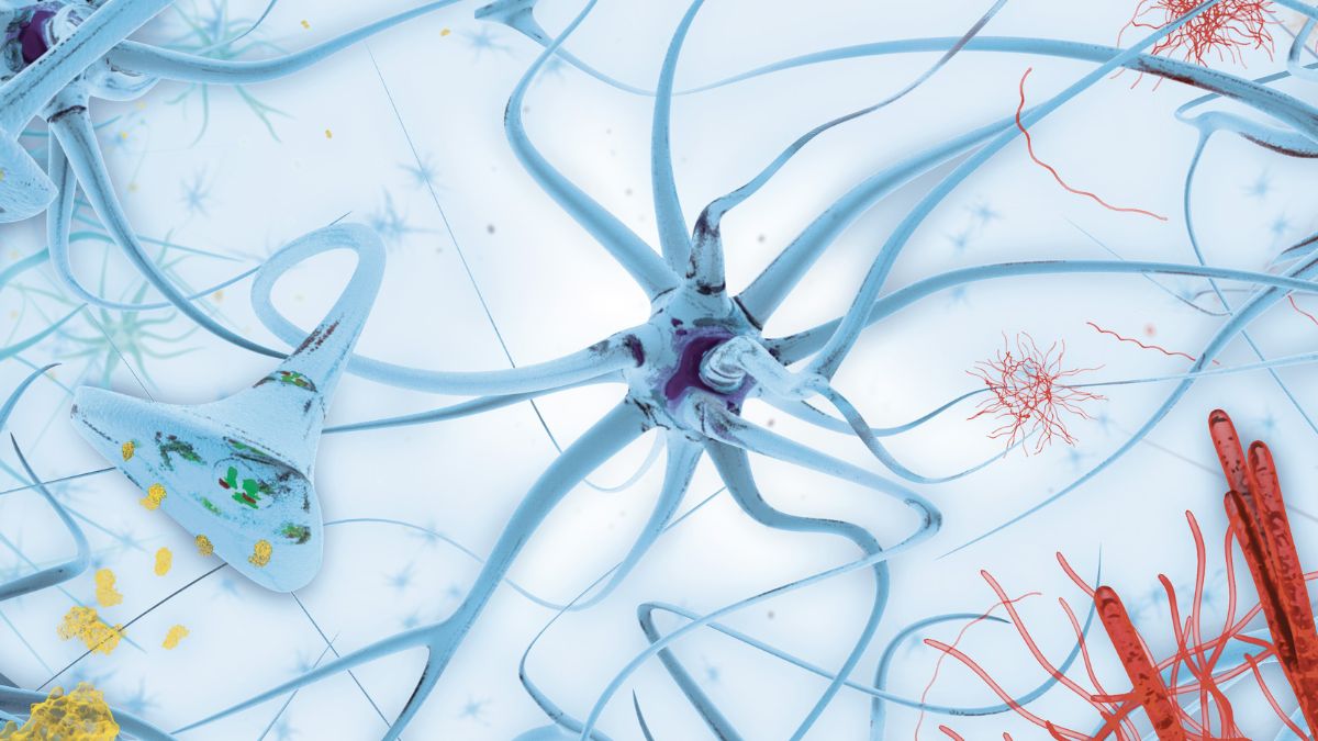 Neuroscience, CNS disorders, Parkinson and Alzheimers