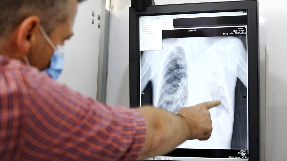 X-Ray examination