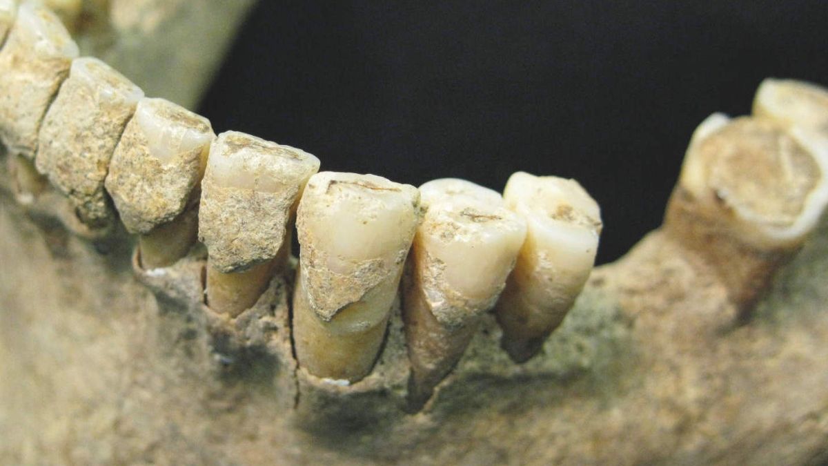 Pathogens and host immunity in the ancient human oral cavity