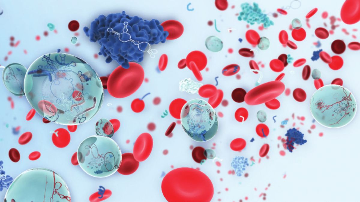  Liquid biopsy, miRNA, lncRNA