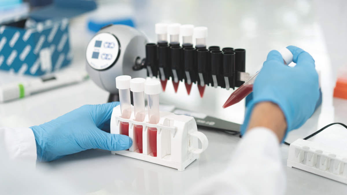 Liquid Biopsy Research