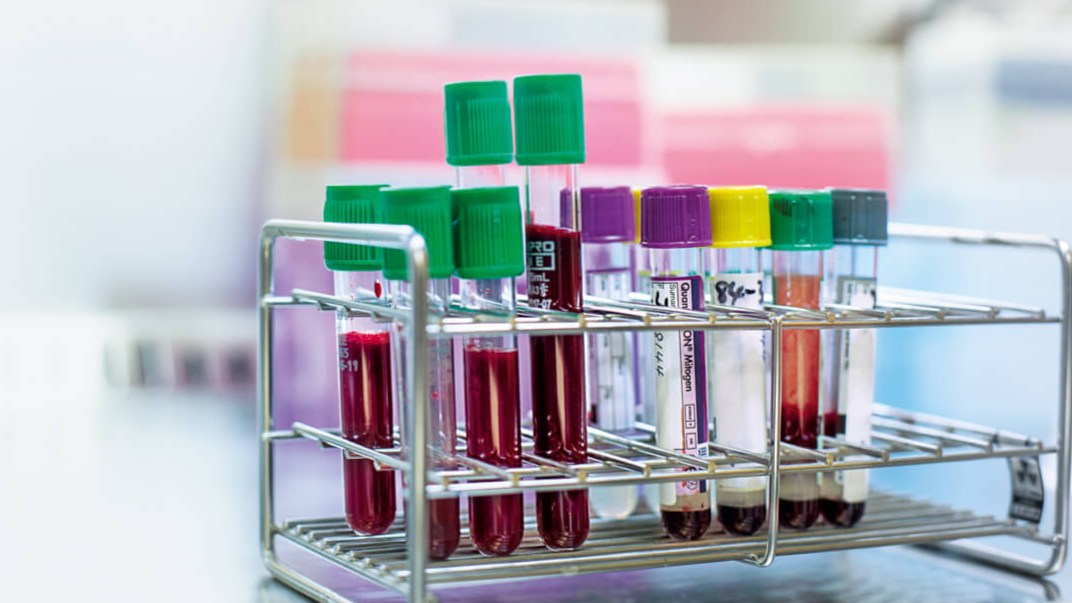 QFT Plus tubes in rack