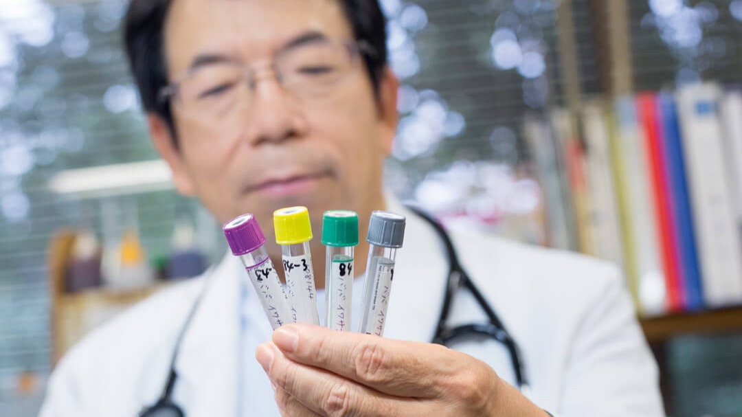 Dr Fukushima holding QFT Plus tubes